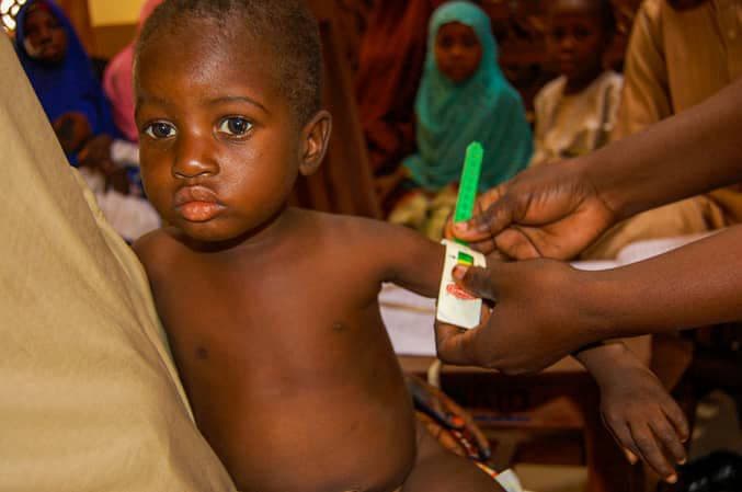 Health worker screening a child for malnutrition with a MUAC tape